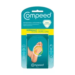COMPEED Kalusinis tinkas, 6 vnt
